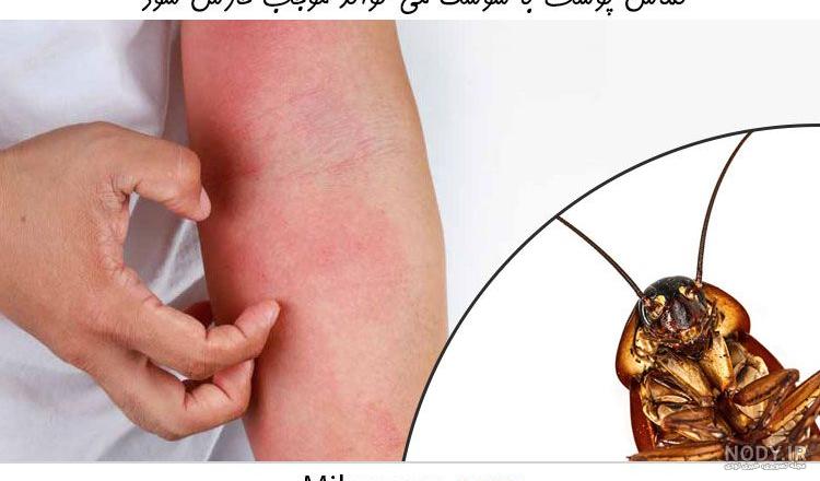 عکس سوسک از نمای نزدیک عکس سوسک از نمای نزدیک