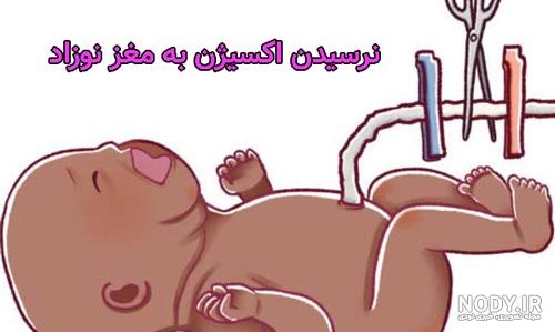 8 علائم مشکل ریه در نوزاد کمتر از یکسال 8 علائم مشکل ریه در نوزاد کمتر از یکسال