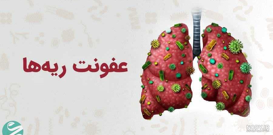 آبسه ریه | مشکلات ریه | آزمایشگاه طبی فارابی | آزمایشگاه فارابی ظفر آبسه ریه | مشکلات ریه | آزمایشگاه طبی فارابی | آزمایشگاه فارابی ظفر