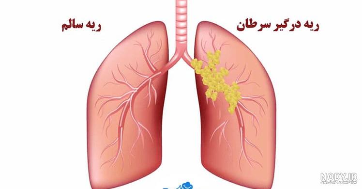 آشنایی مختصر با رادیوگرافی قفسه سینه - درمانکده آشنایی مختصر با رادیوگرافی قفسه سینه - درمانکده