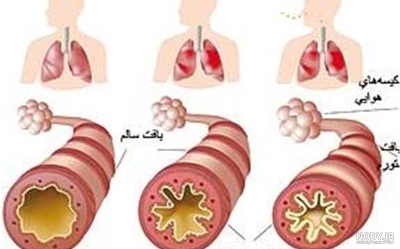 آشنایی مختصر با رادیوگرافی قفسه سینه - درمانکده آشنایی مختصر با رادیوگرافی قفسه سینه - درمانکده