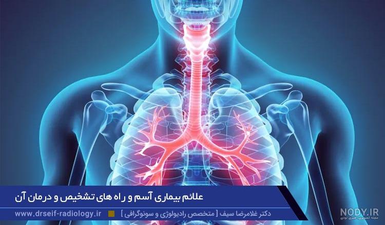 آمبولی ریه چیست؟ 6 راه تشخیص، درمان و پیشگیری - کلینیک دکتر ریاستی