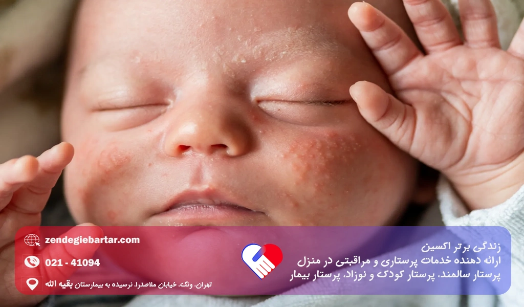 تصویربرداری با جزئیات از ریه نوزاد تازه متولد شده - ایمنا تصویربرداری با جزئیات از ریه نوزاد تازه متولد شده - ایمنا