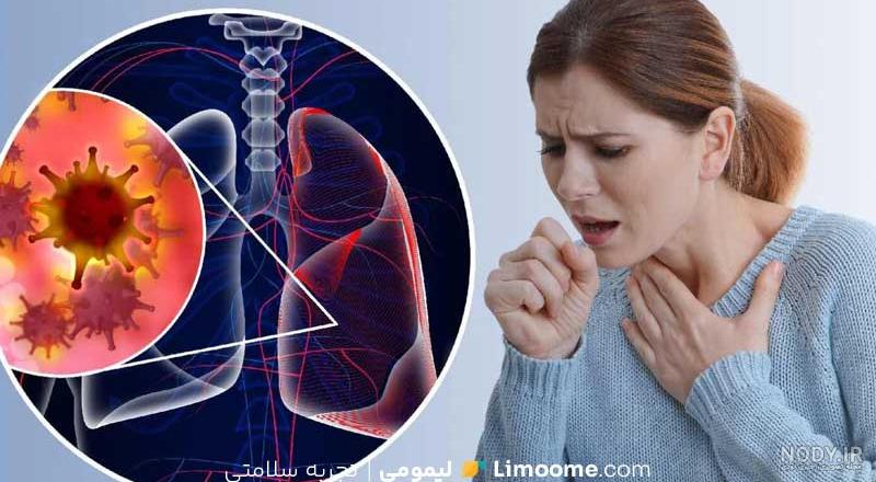 خطرات عفونت ریه برای سلامتی - تسنیم خطرات عفونت ریه برای سلامتی - تسنیم