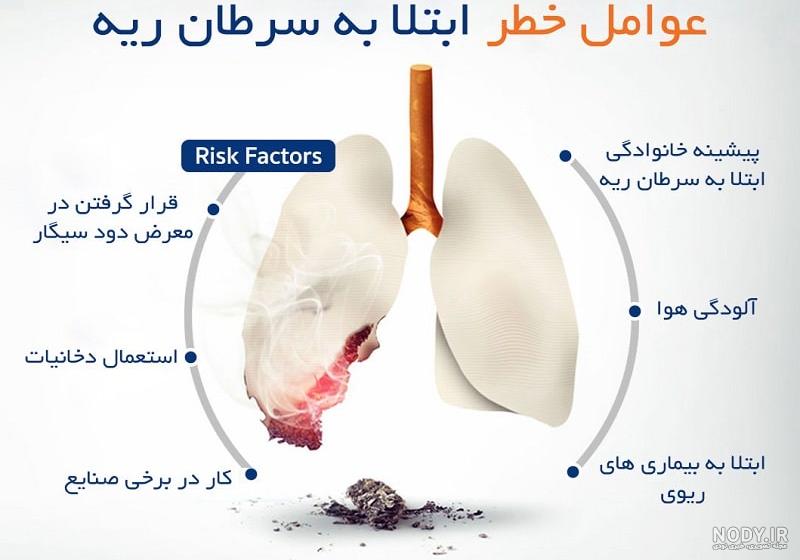 درمان سرطان ریه با استفاده از "سوزن داغ" - ایسنا درمان سرطان ریه با استفاده از "سوزن داغ" - ایسنا