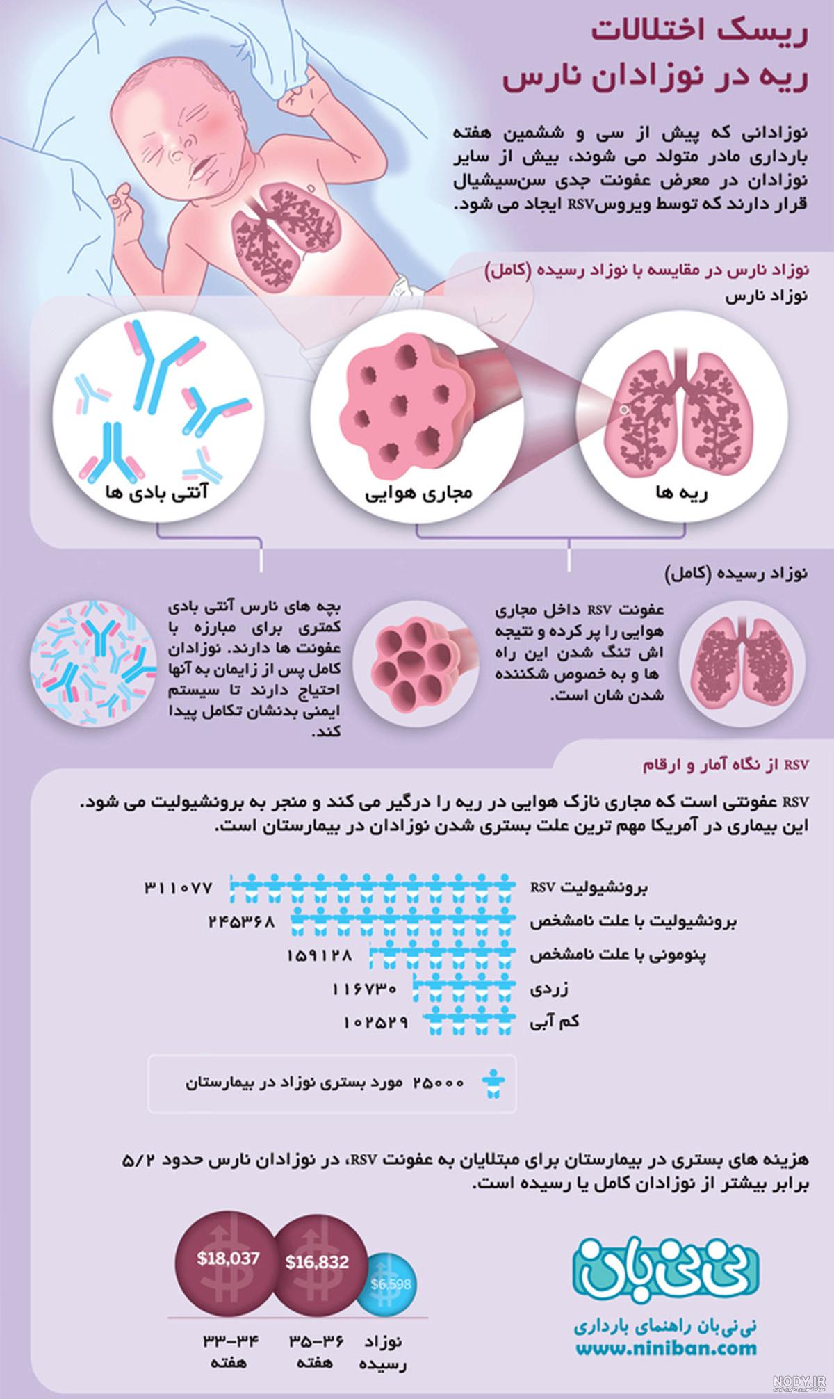 سندرم دیسترس تنفسی ؛ علل، عوامل خطر، نشانه ها، تشخیص و روش های سندرم دیسترس تنفسی ؛ علل، عوامل خطر، نشانه ها، تشخیص و روش های