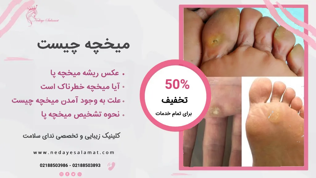 سیاه شدن میخچه نشانه چیست؟⭐آن را جدی بگیرید