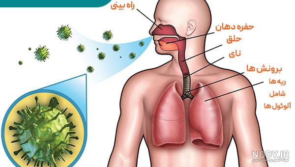 عفونت ریه چیست؟ علائم و درمان آن (راهنمای جامع) • دیجی‌کالا مگ