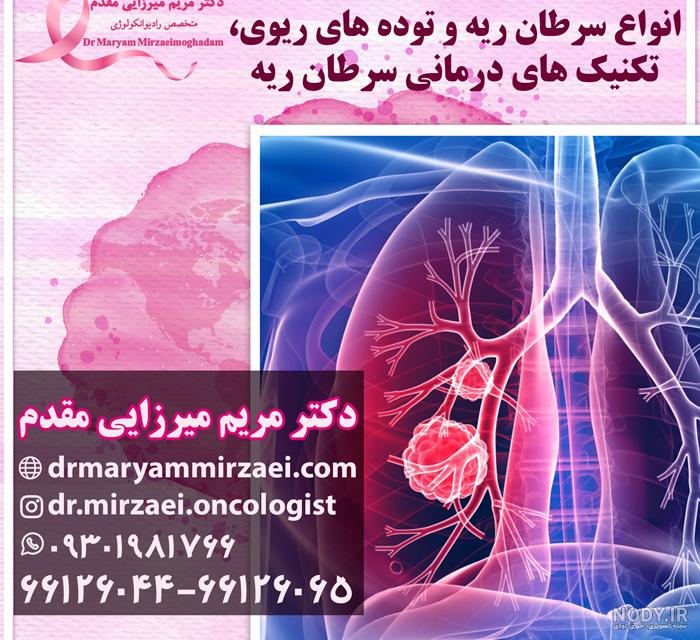علائم سرطان ریه چیست؟ | انواع سرطان ریه و درمان علائم سرطان ریه چیست؟ | انواع سرطان ریه و درمان