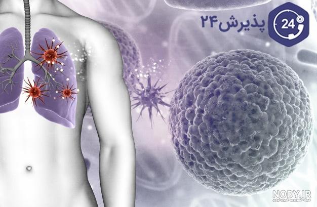 عکس از ریه عفونی