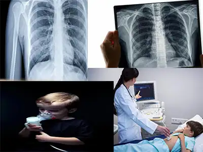 عکس از ریه نوزاد خطرناک است عکس از ریه نوزاد خطرناک است
