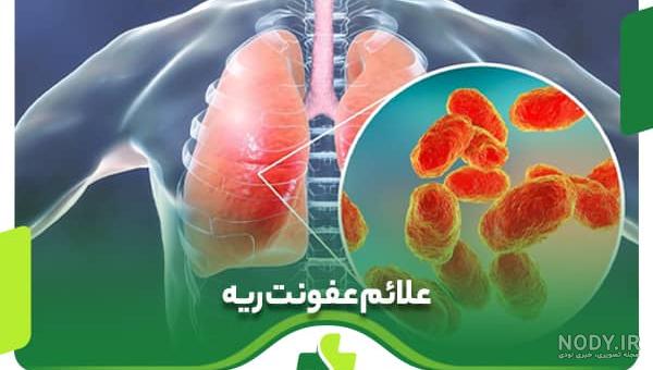 عکس رادیولوژی ریه نوزاد - عکس نودی عکس رادیولوژی ریه نوزاد - عکس نودی