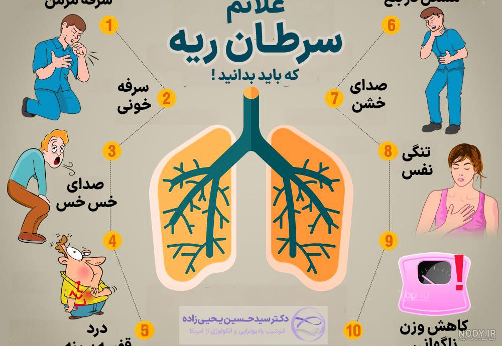 عکس رادیوگرافی عکس رادیوگرافی