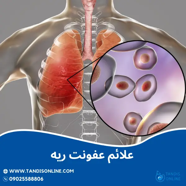عکس ریه عفونتی کودک عکس ریه عفونتی کودک