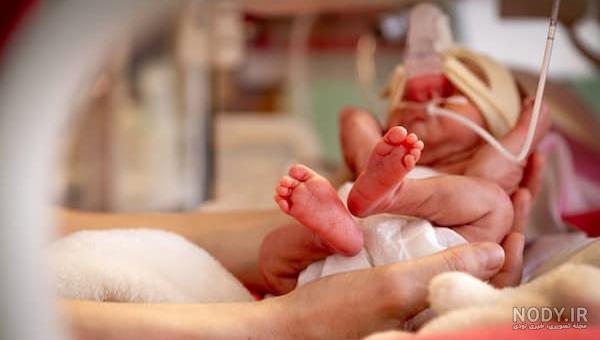 عکس گرفتن از ریه نوزاد عکس گرفتن از ریه نوزاد