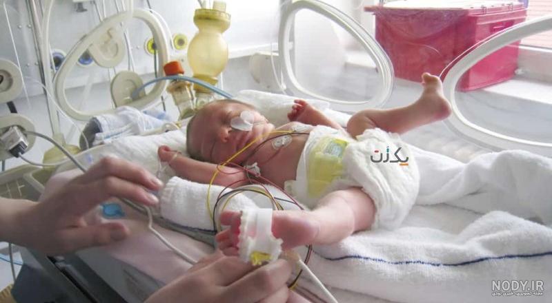 مهمترین مشکلات ویژه نوزادان نارس و روش های مراقبت | گهوارک مهمترین مشکلات ویژه نوزادان نارس و روش های مراقبت | گهوارک