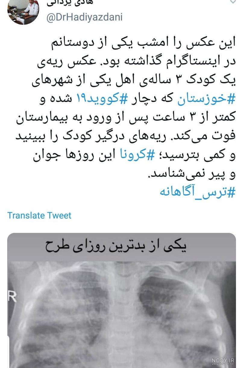 هزینه اسکن ریه در منزل کرج هزینه اسکن ریه در منزل کرج