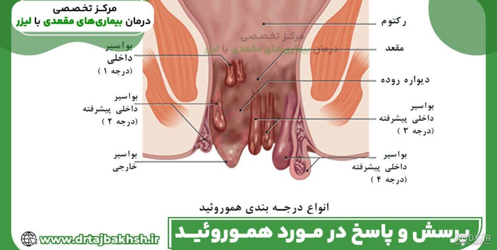 گرفتگی بینی نوزاد | پاک کردن بینی نوزاد - ما نی نی مارکت