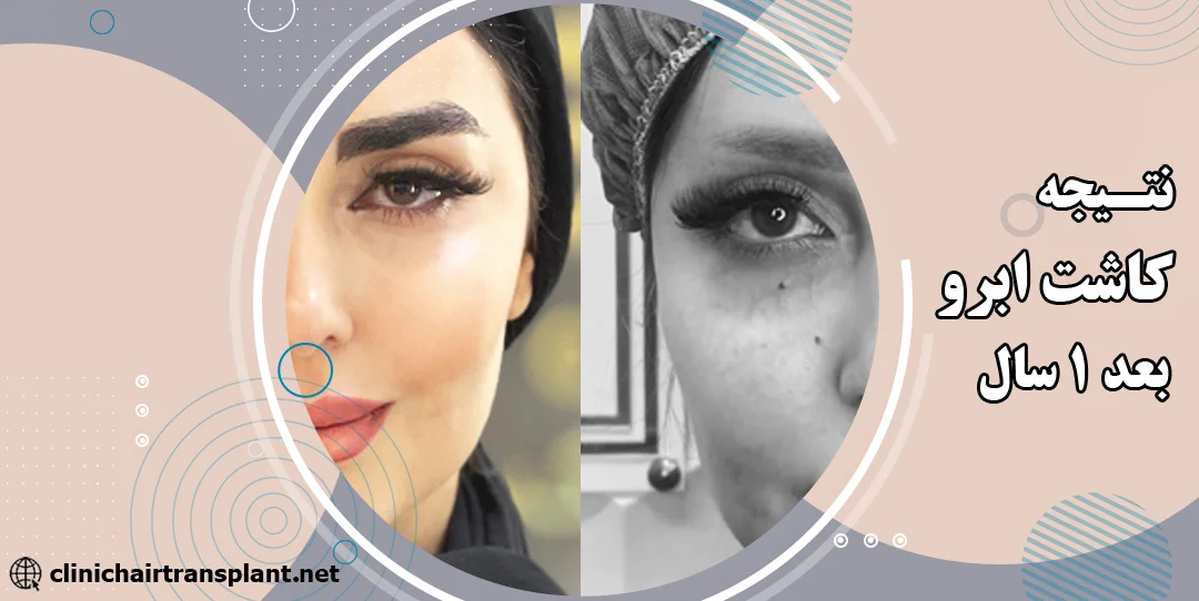 اصلاح ابروی کاشت شده😍به نظرتون کاشت ابرو بهتره یا میکرو بلیدینگ؟🧐رشد ابروی کاشت در حدی هست که هر روز باید کوتاه کنی😎, Crd : @maryammm_eyebrow اصلاح ابروی کاشت شده😍به نظرتون کاشت ابرو بهتره یا میکرو بلیدینگ؟🧐رشد ابروی کاشت در حدی هست که هر روز باید کوتاه کنی😎, Crd : @maryammm_eyebrow