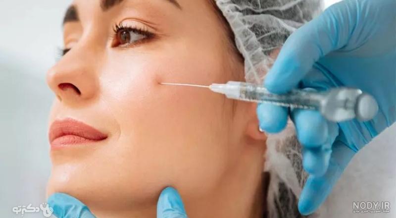 تزریق ژل برای ایجاد کات گونه لازم است؟ - مرکز زیبایی فلور تزریق ژل برای ایجاد کات گونه لازم است؟ - مرکز زیبایی فلور