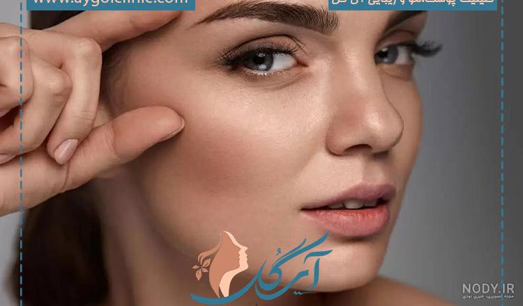 تصاویر قبل و بعد از کاشت ابرو - کلینیک کاشت مو VIP | کلینیک vipkasht | وی آی پی کاشت تصاویر قبل و بعد از کاشت ابرو - کلینیک کاشت مو VIP | کلینیک vipkasht | وی آی پی کاشت
