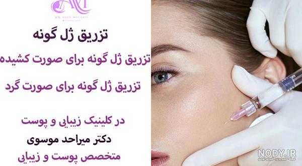چند سی سی ژل برای گونه لازم است ؟ آیا تزریق یک سی سی کافیست - گلوریا سنتر چند سی سی ژل برای گونه لازم است ؟ آیا تزریق یک سی سی کافیست - گلوریا سنتر