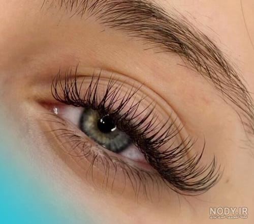 کاشت مژه هیدن (نامرئی) چیست؟ کاشت مژه هیدن (نامرئی) چیست؟