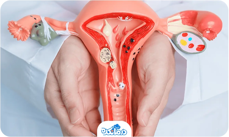 عکس رنگی برای ای وی اف