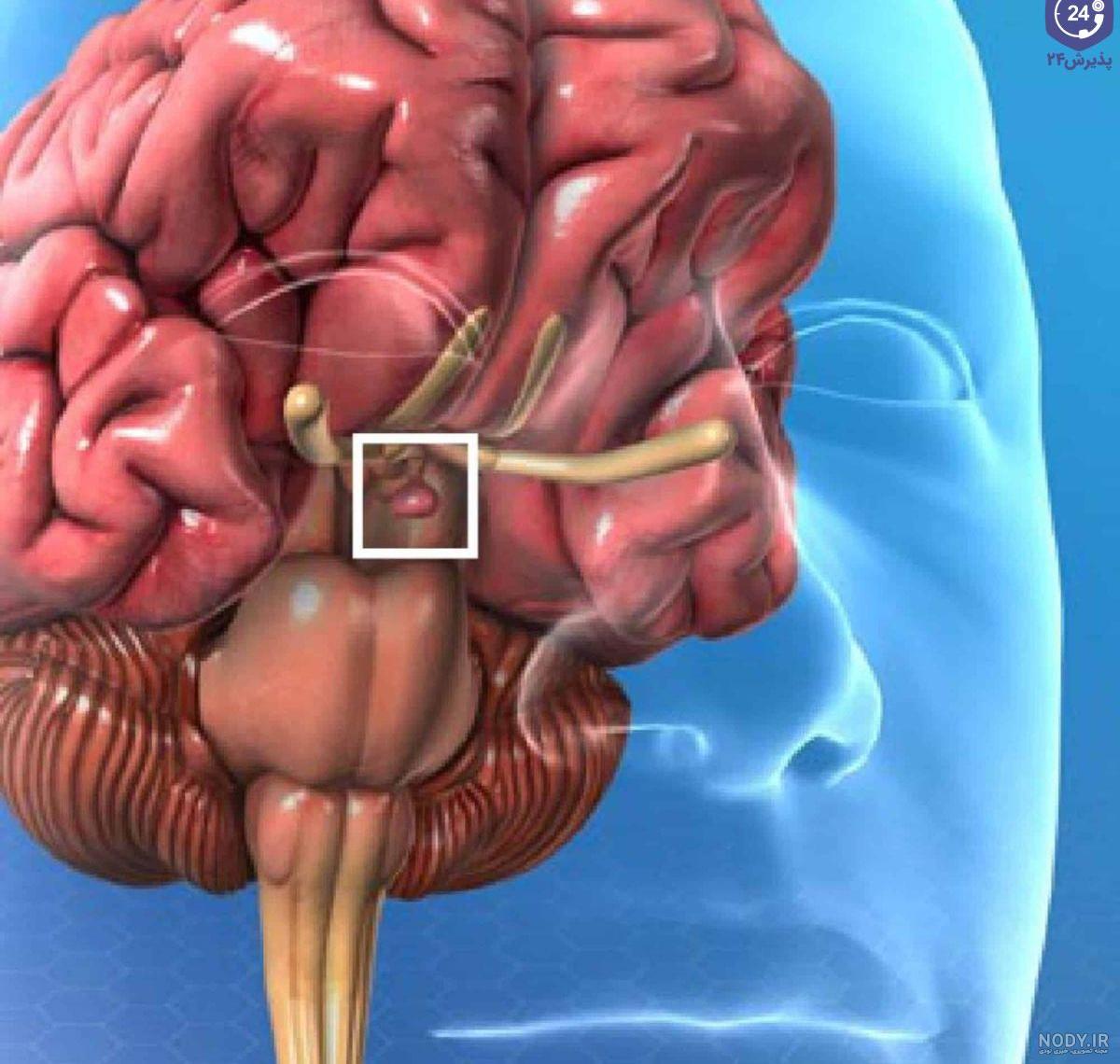 Pituitary MRI | MRI FARSI Pituitary MRI | MRI FARSI