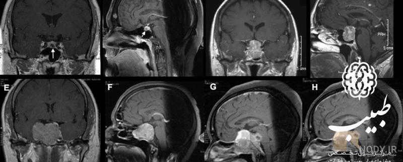 ام آر آی (MRI کاربرد آن در تشخیص بیماری‌های مغز و اعصاب - متخصص مغز و اعصاب  تهران- فوق تخصص بیماری های مغز و نخاع
