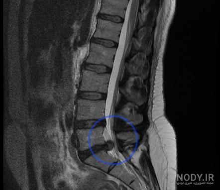 ام آر آی کمر و لگن-تفسیر انلاین ام ار ای(تفسیرmri لگن و کمر) ام آر آی کمر و لگن-تفسیر انلاین ام ار ای(تفسیرmri لگن و کمر)