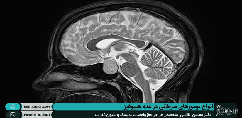 ام ار ای با تزریق: قبل و بعد از ام آر آی با تزریق چه کنیم؟ ام ار ای با تزریق: قبل و بعد از ام آر آی با تزریق چه کنیم؟