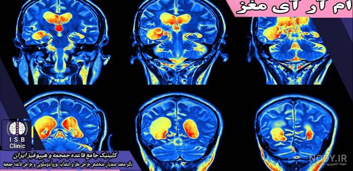 تومور هیپوفیز ، تشخیص ، پیشگیری و درمان | کلینیک طبیب | مرکز فوق تخصصی مغز و اعصاب و ستون فقرات تومور هیپوفیز ، تشخیص ، پیشگیری و درمان | کلینیک طبیب | مرکز فوق تخصصی مغز و اعصاب و ستون فقرات