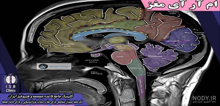 عکس ام ار ای غده هیپوفیز - عکس نودی عکس ام ار ای غده هیپوفیز - عکس نودی
