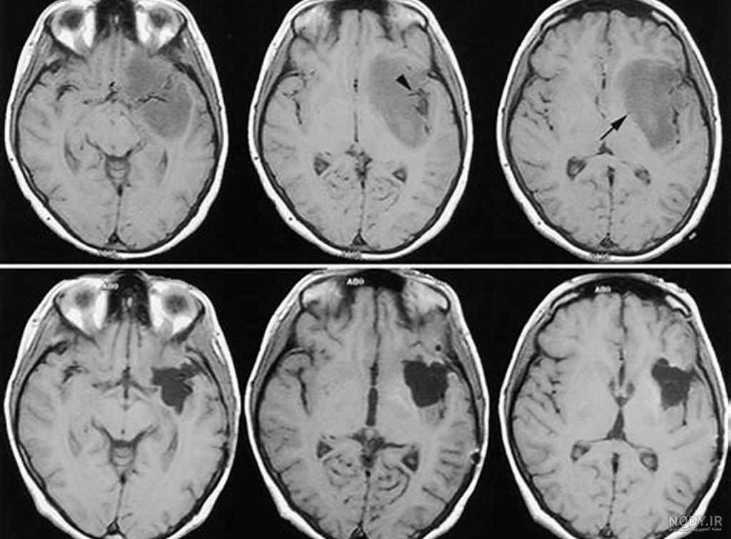 پاسخ به سئوالات رایج درباره ام آر آی (MRI) • تصویربرداری پزشکی بهار پاسخ به سئوالات رایج درباره ام آر آی (MRI) • تصویربرداری پزشکی بهار
