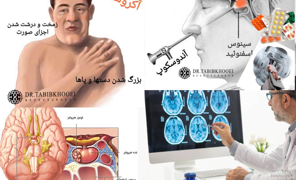 کاربرد ام آر آی در بیماریهای مغز و اعصاب کاربرد ام آر آی در بیماریهای مغز و اعصاب