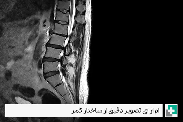 کیس های ام آر آی کمر بایگانی - دکتر قائمیان | مرکز تصویر برداری پزشکی دکتر قائمیان کیس های ام آر آی کمر بایگانی - دکتر قائمیان | مرکز تصویر برداری پزشکی دکتر قائمیان