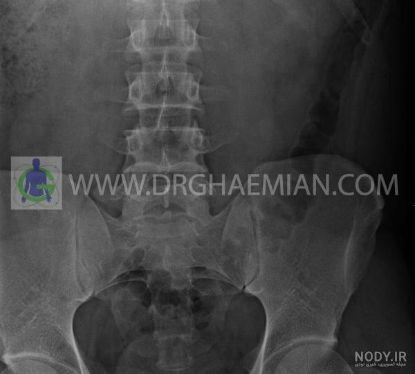 تفاوت رادیولوژی و سی تی اسکن تفاوت رادیولوژی و سی تی اسکن