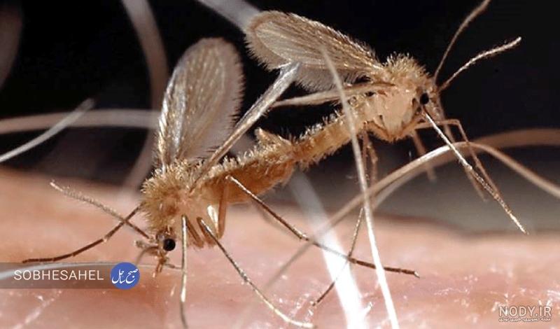دکتر جمال الدین حسن زاده | متخصص پوست و مو در سنندج | درمان بیماری سالک و  جای زخم ناشی از آن