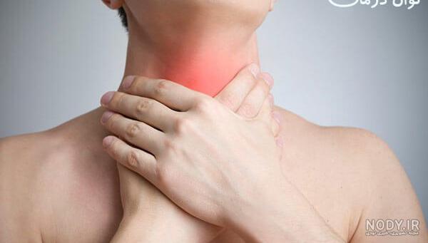 علت خلط گلو چیست؟ + بهترین روش درمان خلط گلو علت خلط گلو چیست؟ + بهترین روش درمان خلط گلو