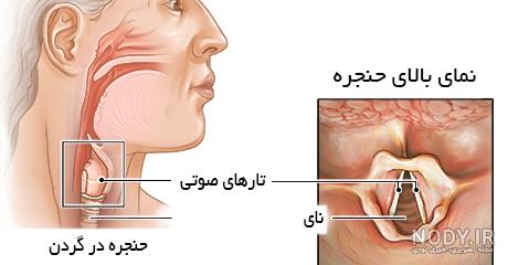 عکس از داخل گلو