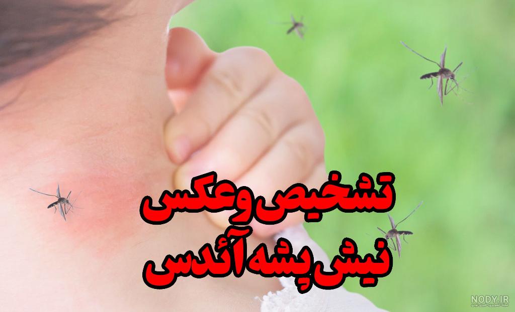 عکس از نیش زدن پشه - عکس نودی عکس از نیش زدن پشه - عکس نودی