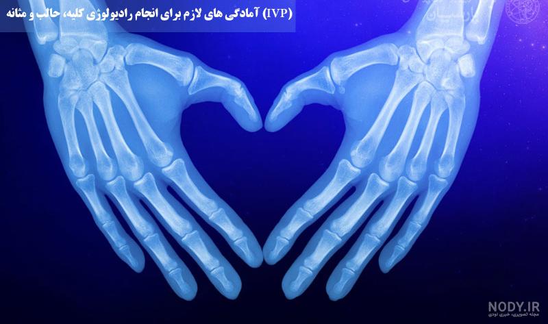 عکس رنگی کلیه تهران/دکتر منصور مبصری - مرکز تصویر برداری سایه عکس رنگی کلیه تهران/دکتر منصور مبصری - مرکز تصویر برداری سایه