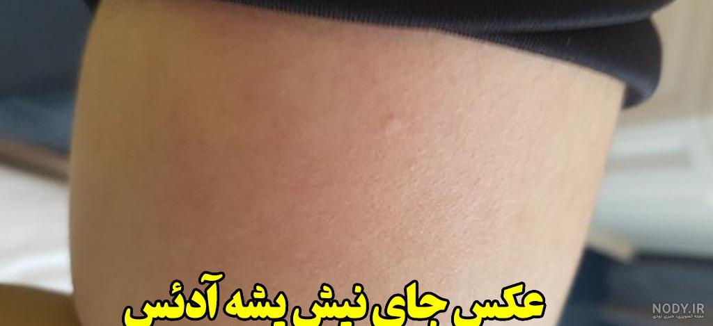 فرارو | هشدار شیوع پشه آئدس در ۷ استان؛ پیک تب دنگی در راه است فرارو | هشدار شیوع پشه آئدس در ۷ استان؛ پیک تب دنگی در راه است