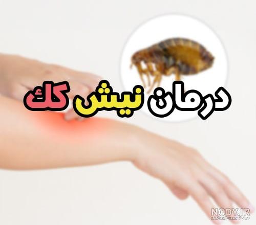 نیش پشه با بدن انسان چه می‌کند؟ - خبرگزاری آنا