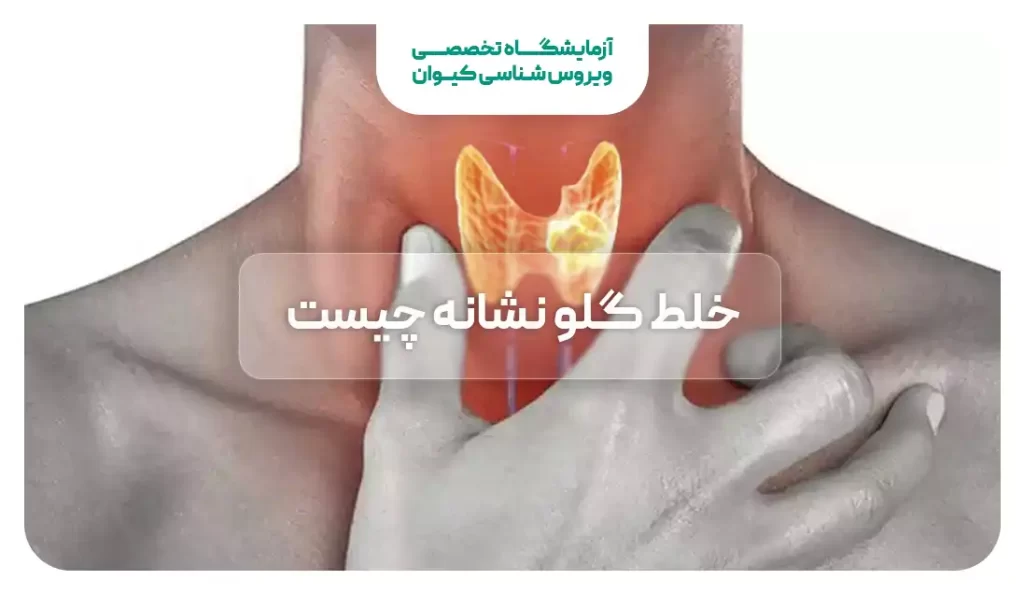 گلودرد چرکی ( استرپتوکوکی) چیست؟ گلودرد چرکی ( استرپتوکوکی) چیست؟
