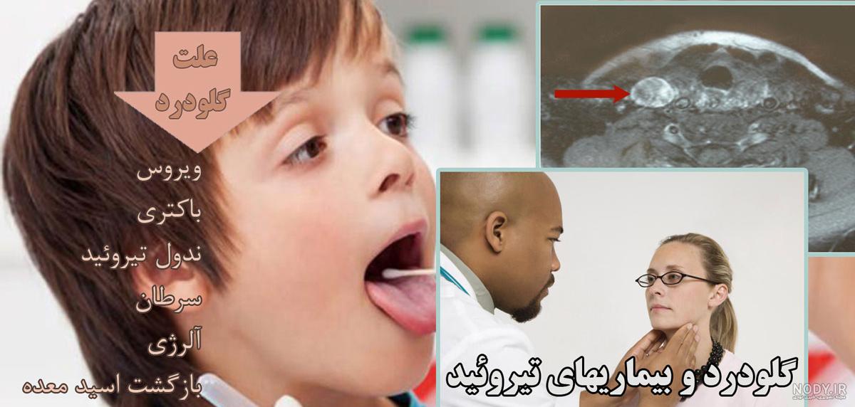 ۹ آنتی بیوتیک طبیعی برای گلو درد و کاهش التهاب گلو ۹ آنتی بیوتیک طبیعی برای گلو درد و کاهش التهاب گلو