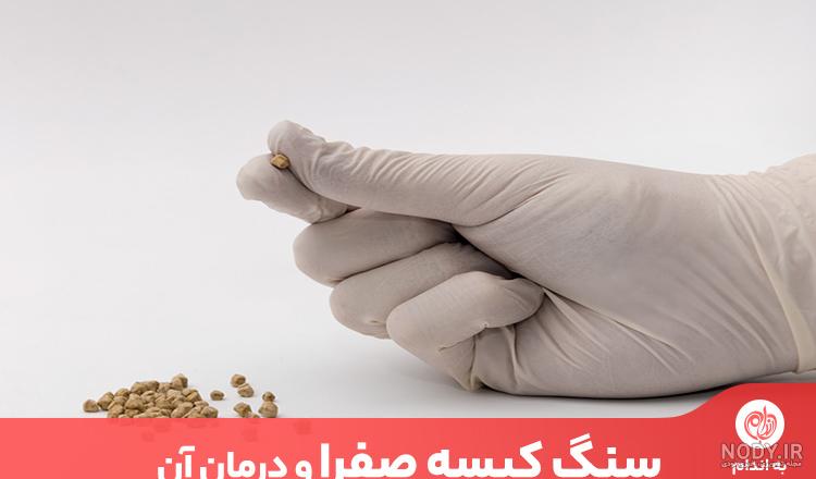 سنگ کیسه صفرا - دکتر فرشاد خسروی