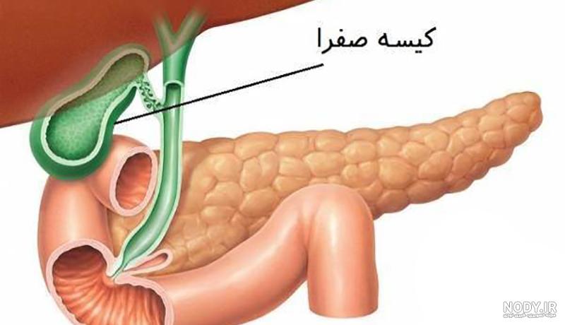سنگ کیسه صفرا عکس - بهترین پزشکان ایران | دکتر لوکیشن