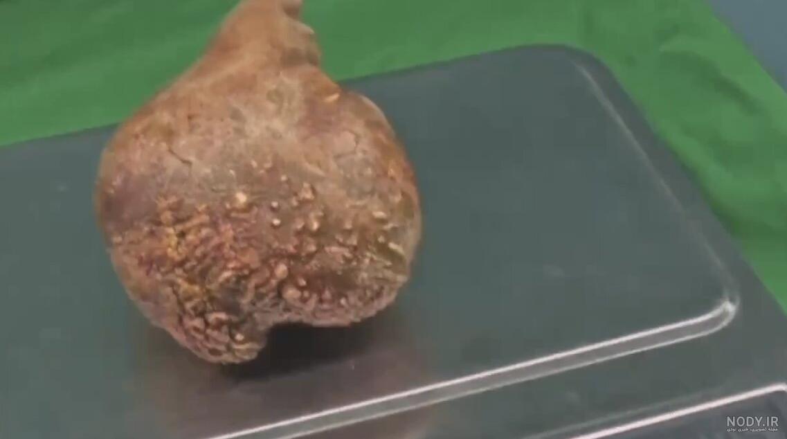 عکس بزرگترین سنگ